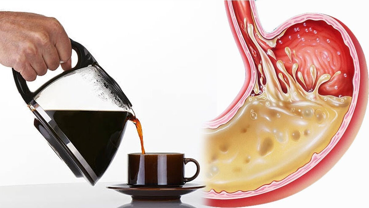 Как кофе влияет на желудок
